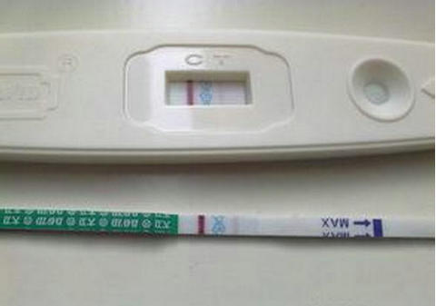 精液分析